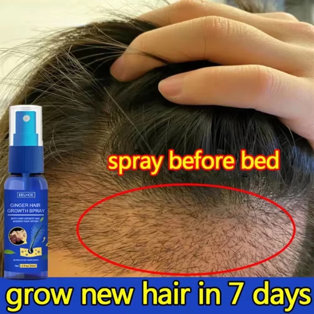 Hair Care Natural - Schnelles Ingwer-Haarwuchsspray für Wurzelwachstum, Anti-Haarausfall, Haarwuchs-Serum,