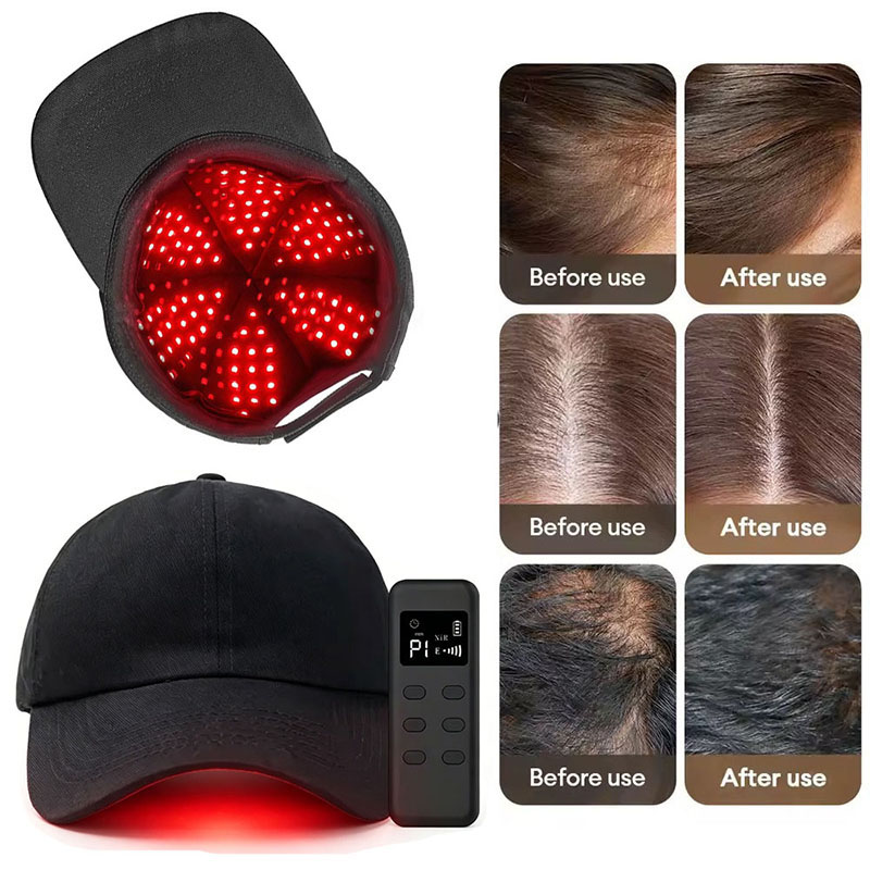 660nm 940nm Lichttherapie-Kapp – Hair Care Wella Bewertung und Preis