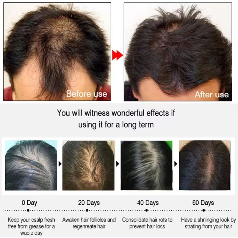 Schnelles Ingwer-Haarwuchsspra – Hair Care Natural Bewertung und Preis